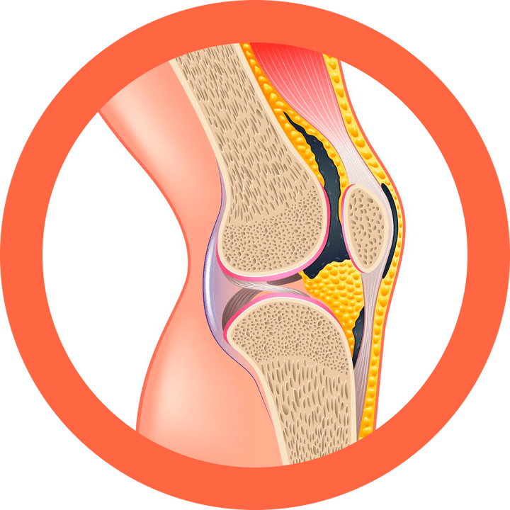 Hondroten - obnavlja sklepe in mišice