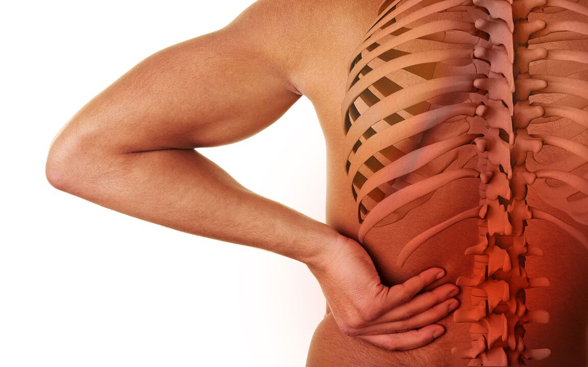 simptomi ledvene osteohondroze
