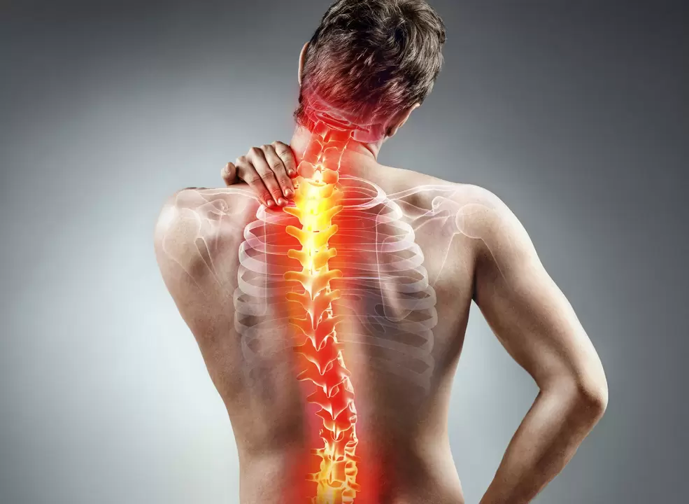 osteohondroza hrbtenice